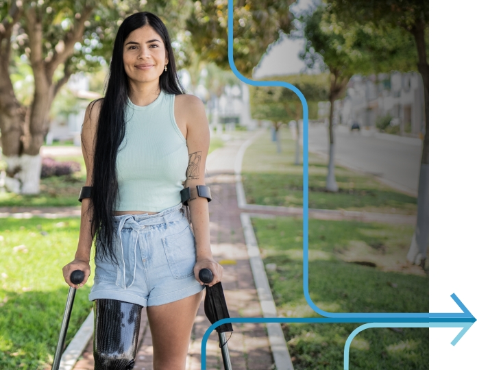 smiling-women-with-prosthetic-leg